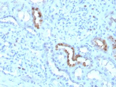 Formalin-fixed, paraffin-embedded human Kidney stained with Calbindin 1 Mouse Monoclonal Antibody (CALB1/3333).