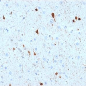 Formalin-fixed, paraffin-embedded human Cerebellum stained with Calretinin Mouse Monoclonal Antibody (CALB2/2602).