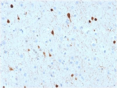 Formalin-fixed, paraffin-embedded human Cerebellum stained with Calretinin Mouse Monoclonal Antibody (CALB2/2602).