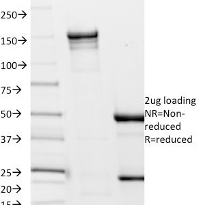 SDS-PAGE Analysis Purified Borrelia burgdorferi (p41 Flagellin) (6802). Confirmation of Integrity and Purity of Antibody.