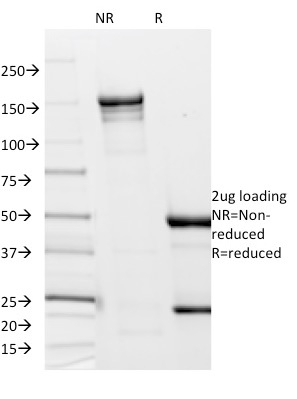 SDS-PAGE Analysis Purified Borrelia burgdorferi (p41 Flagellin) (6802). Confirmation of Integrity and Purity of Antibody.