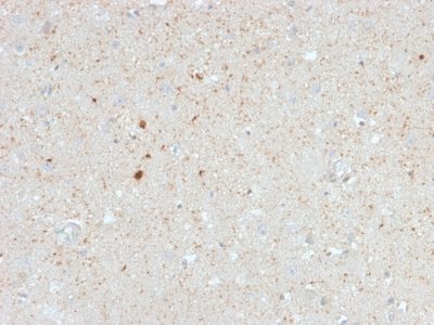 Formalin-fixed, paraffin-embedded human Cerebellum stained with Calretinin Mouse Monoclonal Antibody (CALB2/2603).