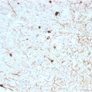 Formalin-fixed, paraffin-embedded human Cerebellum stained with Calretinin Mouse Monoclonal Antibody (CALB2/2786).