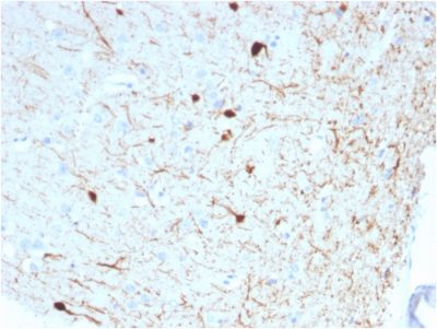 Formalin-fixed, paraffin-embedded human Cerebellum stained with Calretinin Mouse Monoclonal Antibody (CALB2/2786).