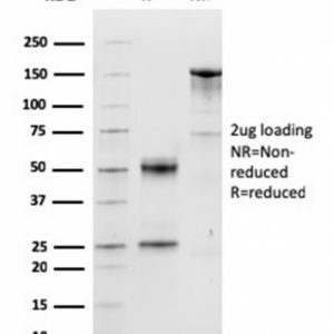 SDS-PAGE Analysis Purified Cyclin D1 Mouse Monoclonal Antibody (CCND1/3548). Confirmation of Purity and Integrity of Antibody.