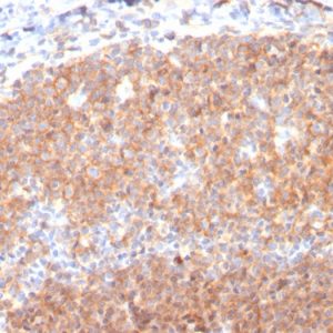 Formalin-fixed, paraffin-embedded human Tonsil stained with CD19 Monospecific Mouse Monoclonal Antibody (CD19/3117).