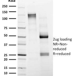 SDS-PAGE Analysis Purified CD4 Mouse Monoclonal Antibody (CD4/1604). Confirmation of Integrity and Purity of Antibody.