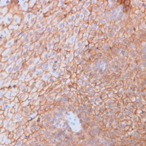 Formalin-fixed, paraffin-embedded human Spleen stained with CD40L-Monospecific Mouse Monoclonal Antibody (CD40LG/2761).