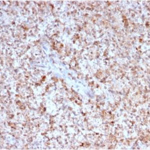 Formalin-fixed, paraffin-embedded human Spleen stained with CD40 Ligand Mouse Monoclonal Antibody (CD40LG/2763).