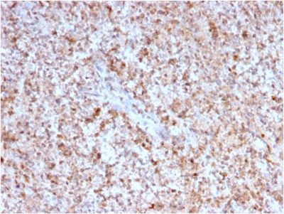 Formalin-fixed, paraffin-embedded human Spleen stained with CD40 Ligand Mouse Monoclonal Antibody (CD40LG/2763).