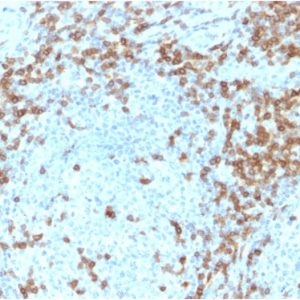 Formalin-fixed, paraffin-embedded human Tonsil stained with CD5-Monospecific Mouse Monoclonal Antibody (CD5/2418).