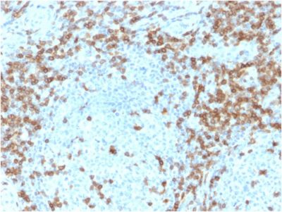 Formalin-fixed, paraffin-embedded human Tonsil stained with CD5-Monospecific Mouse Monoclonal Antibody (CD5/2418).