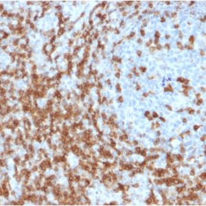 Formalin-fixed, paraffin-embedded human Tonsil stained with CD5 Mouse Monoclonal Antibody (CD5/2419).