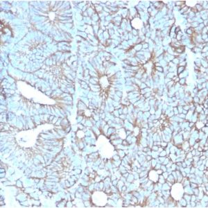 Formalin-fixed, paraffin-embedded human Colon stained with Cadherin 17 / CDH17 Mouse Monoclonal Antibody (CDH17/2617).