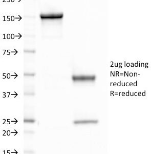 SDS-PAGE Analysis Purified CELA3B Mouse Monoclonal Antibody (CELA3B/1758). Confirmation of Purity and Integrity of Antibody.
