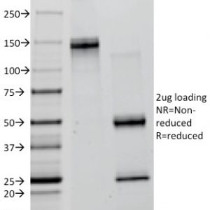 SDS-PAGE Analysis Purified Creatine Kinase-B (CKB) Mouse Monoclonal Antibody (CKB/1268). Confirmation of Integrity and Purity of Antibody.