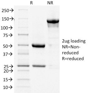 SDS-PAGE Analysis Purified COX-2 Mouse Monoclonal Antibody (COX2/1941). Confirmation of Integrity and Purity of Antibody.
