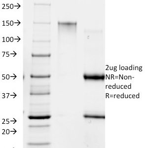 SDS-PAGE Analysis Purified RANK Giardia lamblia Mouse Monoclonal Antibody (BB1.1E5). Confirmation of Purity and Integrity of Antibody.