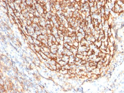 Formalin-fixed, paraffin-embedded human Tonsil Dendritic stained with CD21-Monospecific Mouse Monoclonal Antibody (CR2/2754).