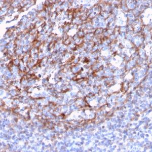 Formalin-fixed, paraffin-embedded human Tonsil Dendritic stained with CD21 / CR2 Recombinant Rabbit Monoclonal Antibody (CR2/3124R).