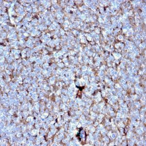 Formalin-fixed, paraffin-embedded human Tonsil stained with Cystatin A Mouse Monoclonal Antibody (CSTA/2882).