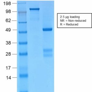 SDS-PAGE Analysis Purified Catenin, gamma Rabbit Monoclonal Antibody (CTNG/2155R). Confirmation of Purity and Integrity of Antibody.