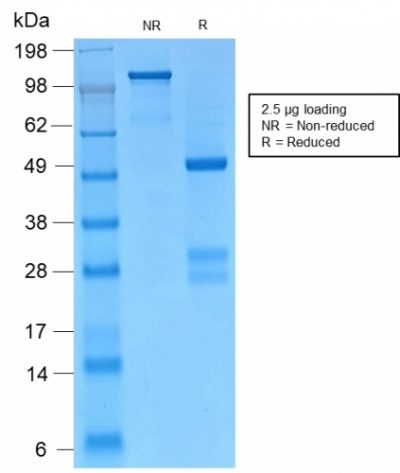 SDS-PAGE Analysis Purified Catenin, gamma Rabbit Monoclonal Antibody (CTNG/2155R). Confirmation of Purity and Integrity of Antibody.