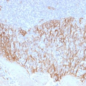 Formalin-fixed, paraffin-embedded human Tonsil stained with Beta-Catenin Mouse Monoclonal Antibody (CTNNB1/2099).
