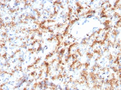 Formalin-fixed, paraffin-embedded human Liver stained with Cathepsin D Mouse Monoclonal Antibody (CTSD/3082).