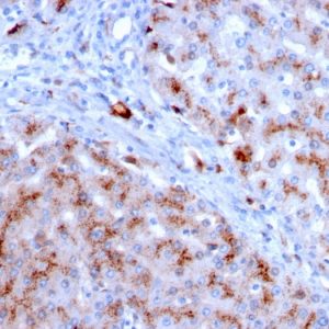 Formalin-fixed, paraffin-embedded human Liver stained with Cathepsin D Mouse Monoclonal Antibody (CTSD/3083).
