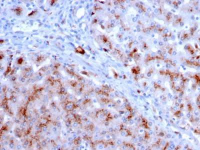 Formalin-fixed, paraffin-embedded human Liver stained with Cathepsin D Mouse Monoclonal Antibody (CTSD/3083).