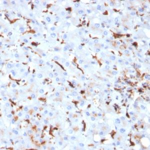 Formalin-fixed, paraffin-embedded human Liver stained with Cathepsin K Mouse Monoclonal Antibody (CTSK/2793).