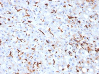 Formalin-fixed, paraffin-embedded human Liver stained with Cathepsin K Mouse Monoclonal Antibody (CTSK/2793).