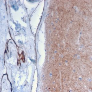 Formalin-fixed, paraffin-embedded human Brain stained with Drebrin-1 Mouse Monoclonal Antibody (DBN1/2879).