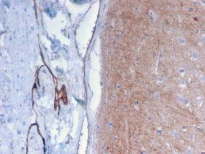 Formalin-fixed, paraffin-embedded human Brain stained with Drebrin-1 Mouse Monoclonal Antibody (DBN1/2879).