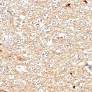 Formalin-fixed, paraffin-embedded human Brain stained with Drebrin-1 Mouse Monoclonal Antibody (DBN1/2880).