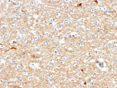 Formalin-fixed, paraffin-embedded human Brain stained with Drebrin-1 Mouse Monoclonal Antibody (DBN1/2880).