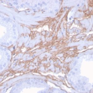 Formalin-fixed, paraffin-embedded human Prostate stained with Decorin Mouse Monoclonal Antibody (DCN/3523).