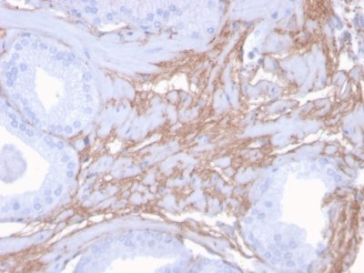 Formalin-fixed, paraffin-embedded human Prostate stained with Decorin Mouse Monoclonal Antibody (DCN/3523).