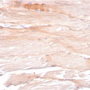 Formalin-fixed, paraffin-embedded human Skeletal Muscle stained with Dystrophin Monospecific Mouse Monoclonal Antibody (DMD/3241).