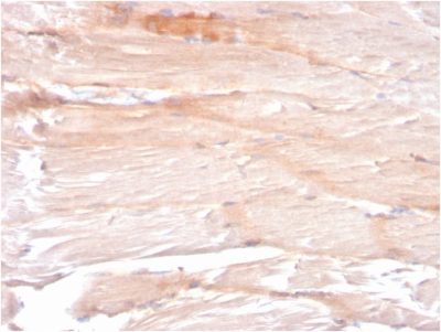 Formalin-fixed, paraffin-embedded human Skeletal Muscle stained with Dystrophin Monospecific Mouse Monoclonal Antibody (DMD/3241).