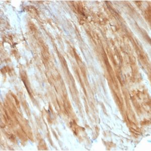 Formalin-fixed, paraffin-embedded human Skeletal Muscle stained with Dystrophin Monospecific Mouse Monoclonal Antibody (DMD/3243).