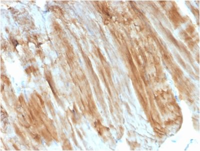 Formalin-fixed, paraffin-embedded human Skeletal Muscle stained with Dystrophin Monospecific Mouse Monoclonal Antibody (DMD/3243).
