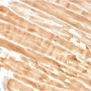 Formalin-fixed, paraffin-embedded human Skeletal Muscle stained with Dystrophin Monospecific Mouse Monoclonal Antibody (DMD/3244).