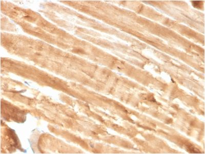 Formalin-fixed, paraffin-embedded human Skeletal Muscle stained with Dystrophin Monospecific Mouse Monoclonal Antibody (DMD/3244).