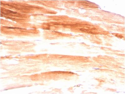 Formalin-fixed, paraffin-embedded human Skeletal Muscle stained with Dystrophin Monospecific Mouse Monoclonal Antibody (DMD/3245).