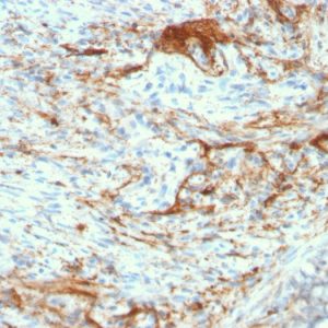 Formalin-fixed, paraffin-embedded human Small Intestine stained with Rabbit Recombinant Monoclonal Antibody (ELN/3131R) to Elastin.