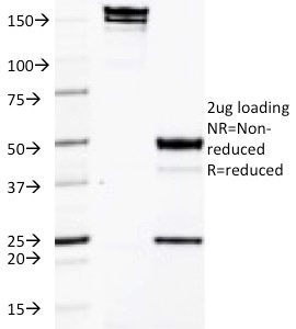 SDS-PAGE Analysis Purified CD50 Mouse Monoclonal Antibody (CG106). Confirmation of Purity and Integrity of Antibody.