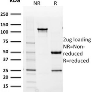 SDS-PAGE Analysis Purified AKR1B1 Mouse Monoclonal Antibody (CPTC-AKR1B1-2). Confirmation of Purity and Integrity of Antibody.