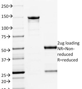 SDS-PAGE Analysis Purified ETS1 Mouse Monoclonal Antibody (ETS1/1801). Confirmation of Integrity and Purity of Antibody.